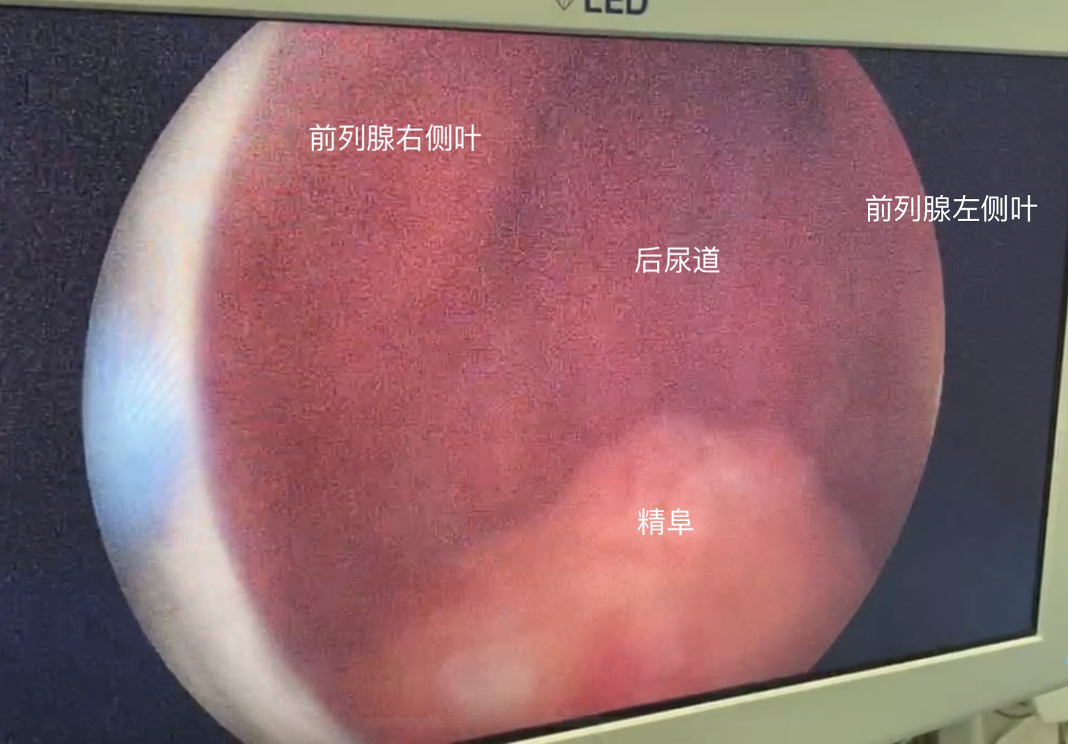 今易健茯苓桃仁官网_金易健茯苓桃仁胶囊_金易健茯苓桃仁胶囊说明书