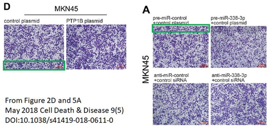 南京大学医学院附属鼓楼医院发表的SCI论文因图片疑似重复被质疑