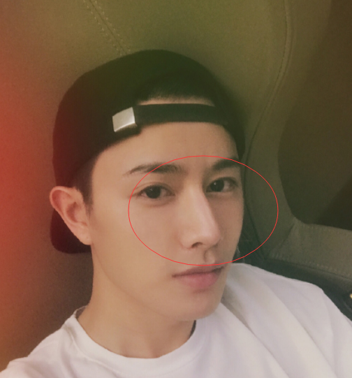 满屏都是欧双高鼻梁,不是亲生就是一个医生