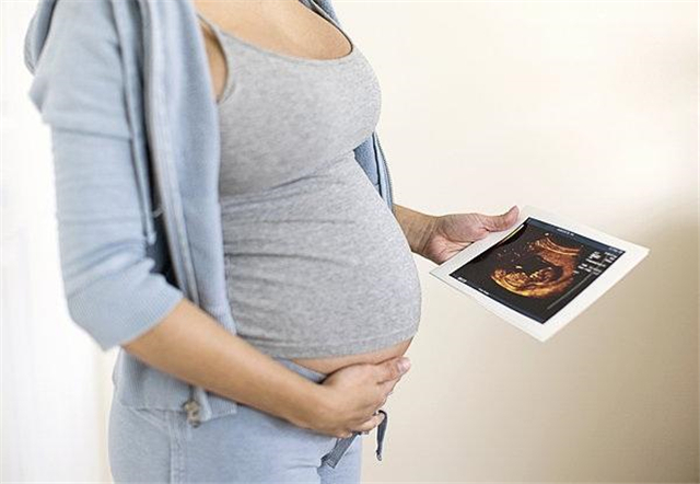 孩子的“胎记”从何而来？孕期这些举动是“诱因”，宝妈要避免