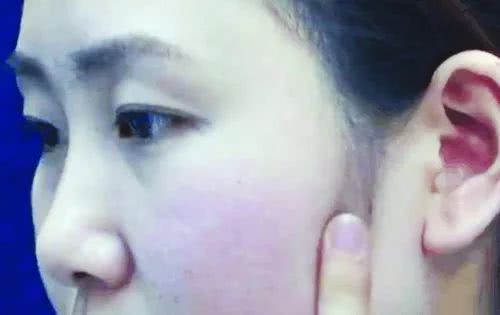 厦门一男子拔牙6颗，牙痛依旧，一查竟是“天下第一痛”惹的祸