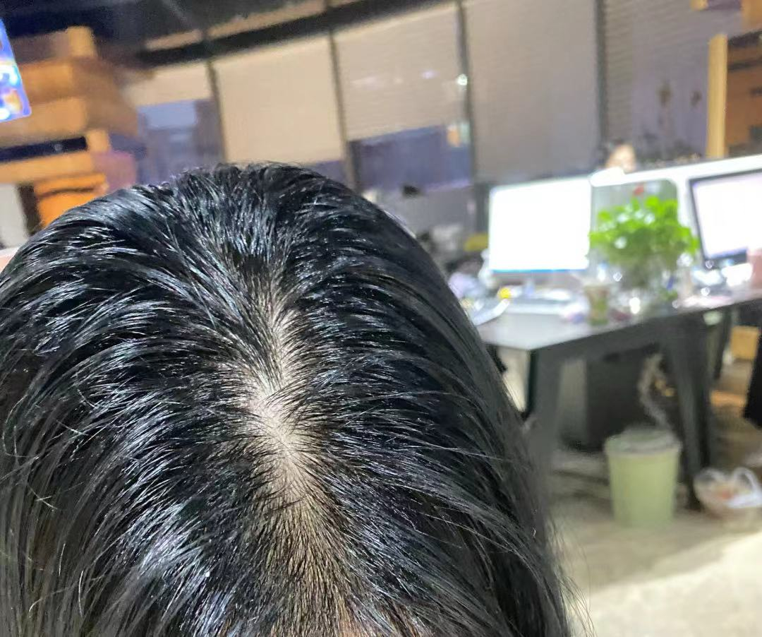 油头脱发适合什么洗发水（推荐4款最适合大油头的洗发水）