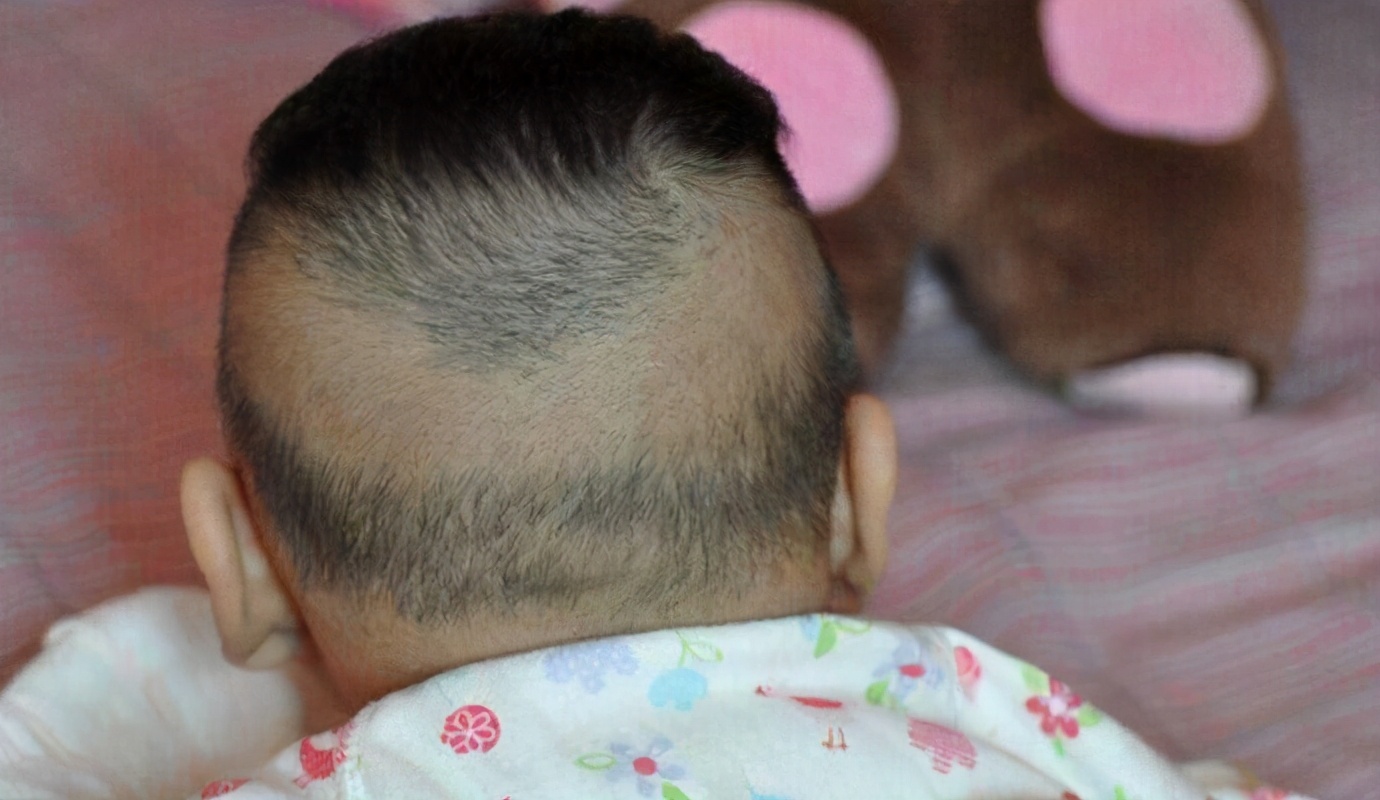 婴儿理发发型图片大全（发质少）-幼儿百科-魔术铺
