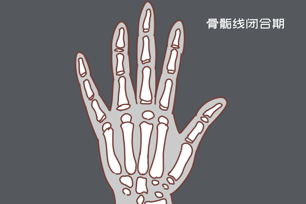 骨骼线闭合有什么表现