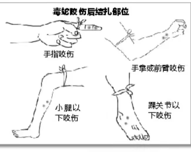 吓人！云南惊现3米“毒王”眼镜王蛇：手臂粗，为何遇到不能打？