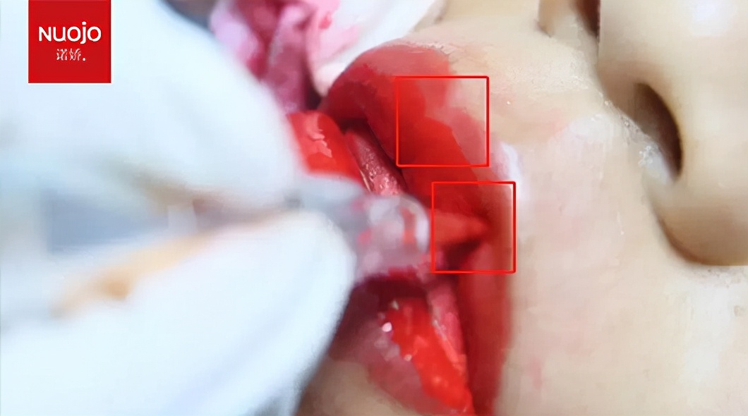 哪种纹唇技术比较好？纹唇技术常用针法汇总，适合纹绣培训纹绣师