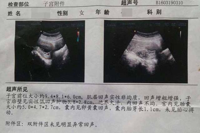 为什么孕妇胎停越来越普遍？这些是“罪魁祸首”，第四个最重要