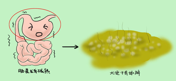 宝宝形色各异的大便正常吗，听听医生怎么讲