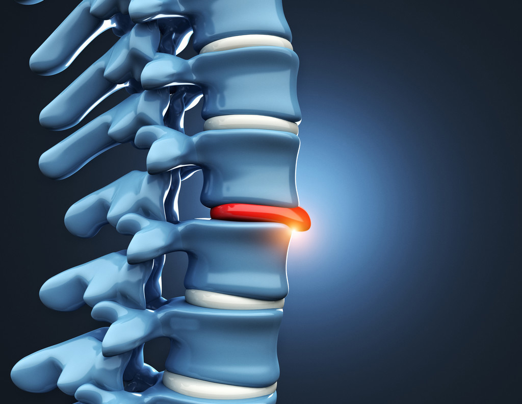 6个缓解腰椎间盘突出的伸展运动，避免7个训练，强壮腰椎不踩雷