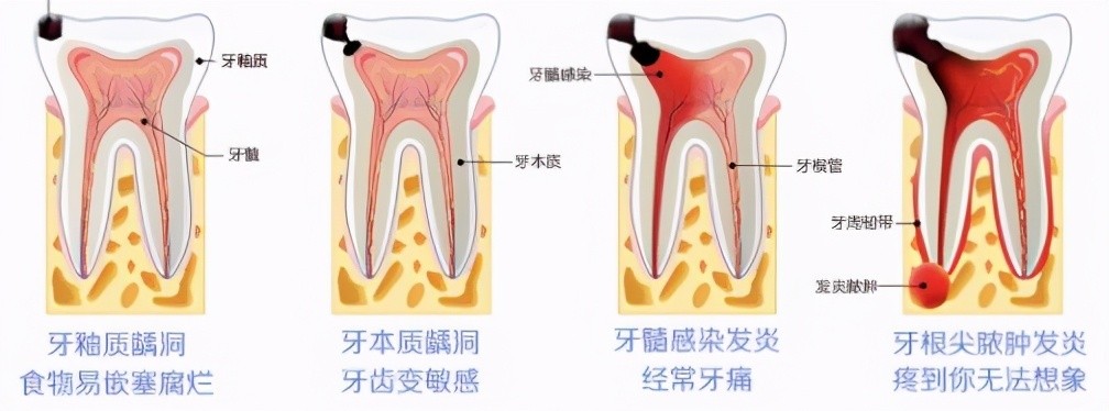 看个牙疼价格几十到几千，收费多少到底谁来决定？