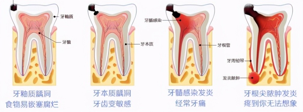 看个牙疼价格几十到几千，收费多少到底谁来决定？