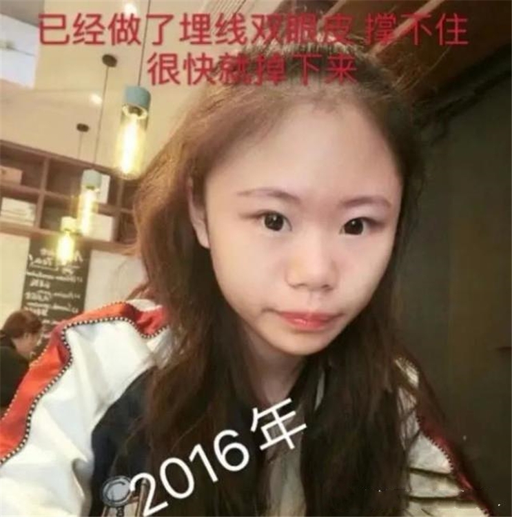 15岁女孩花400多万整容，后悔整太早：想知道自己自然长大的样子