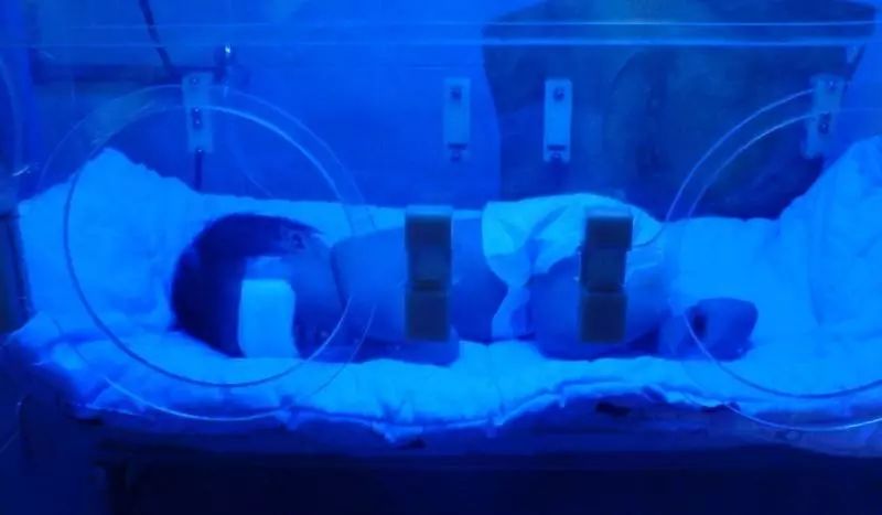 美容院光子嫩肤贼贵?却不知李湘、张檬、黄圣依都在用的美容仪