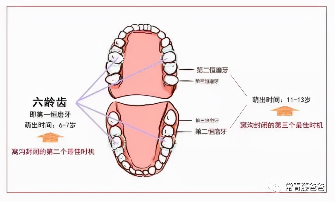 6-12岁换牙时间和换牙期问题大盘点！孩子一口好牙关键就在这几点