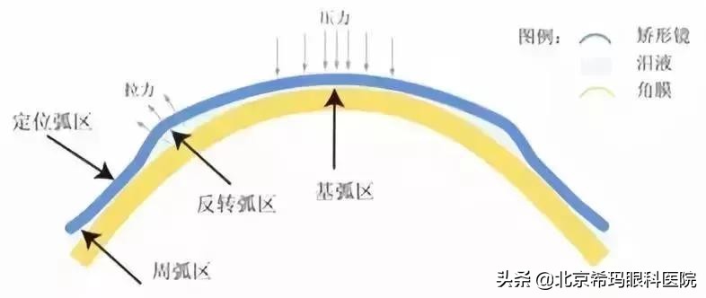 这四大青少年近视防控“神器”，你更“青睐”谁？