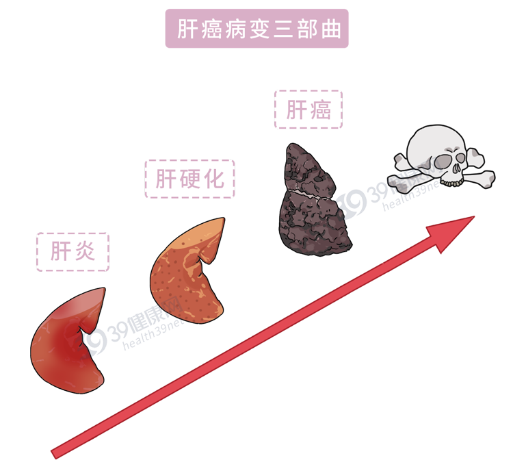 吃什么补肝护肝 肝气不顺怎么调理