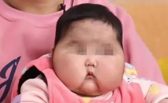 满月脸怎么办（宝宝很胖，“满月脸”是什么情况？医生：一起看看库欣综合症）