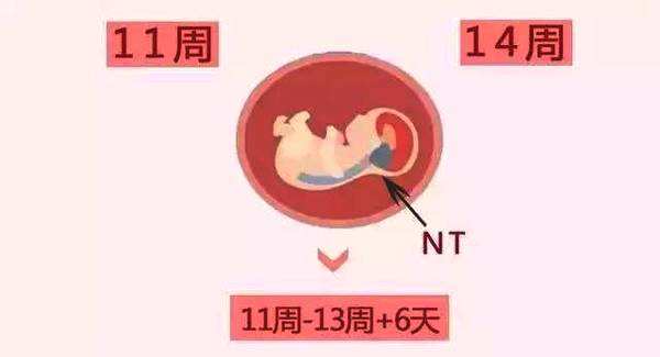 孕妇做NT检查也有技巧，要是做不好这4点，3次4次不通过都有可能