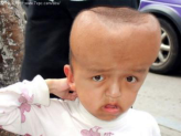 孩子的头大、头小、偏头，方颅，是什么原因？一次性弄清楚