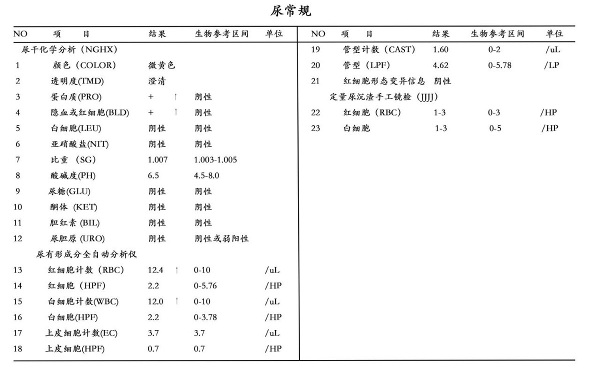 尿常规主要看哪几个指标？提醒：尿液若出现这四种颜色要当心了