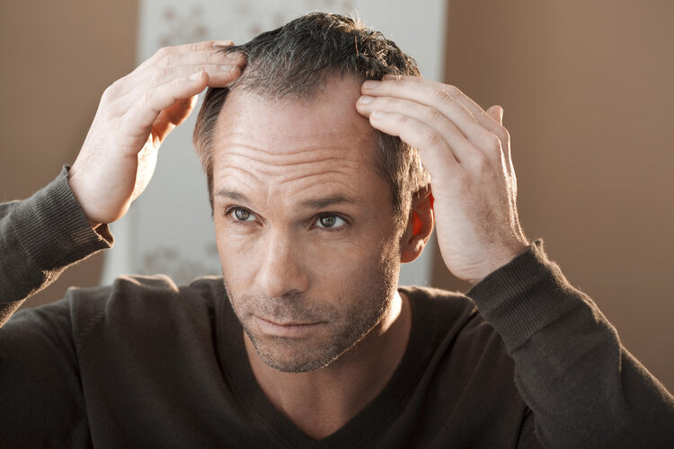 年纪轻轻就脱发？5大恶习是脱发的“催化剂”，医生分享治疗方案