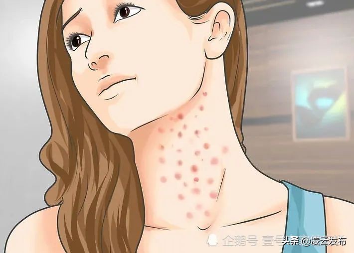 女人艾滋病的三大症状图片图片