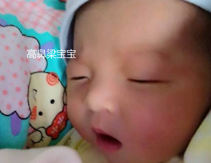 婴儿的鼻子可以捏高吗(宝宝的鼻梁何时) - 乐宝宝贝