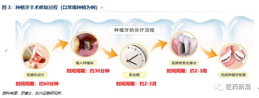 种植牙行业报告：核心技术国外垄断，每颗种植牙成本2000卖1万