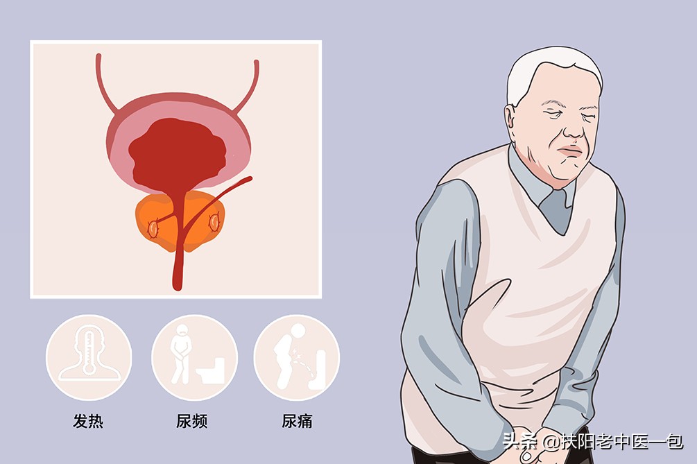 得了前列腺炎该不该经常服用一些消炎药？