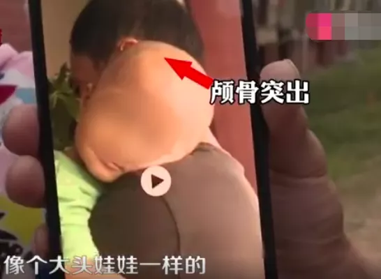 “大头娃娃”重现湖南！涉事奶粉老板为上市乳企高管