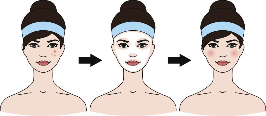 刷酸不护理，后悔来不及！护理步骤要紧记