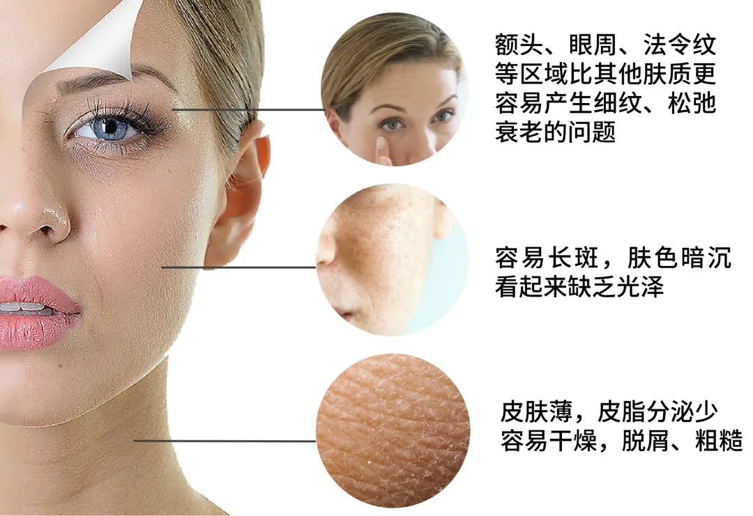 想要换季脸不干，只要做对这件事，一文教你干皮怎么护肤