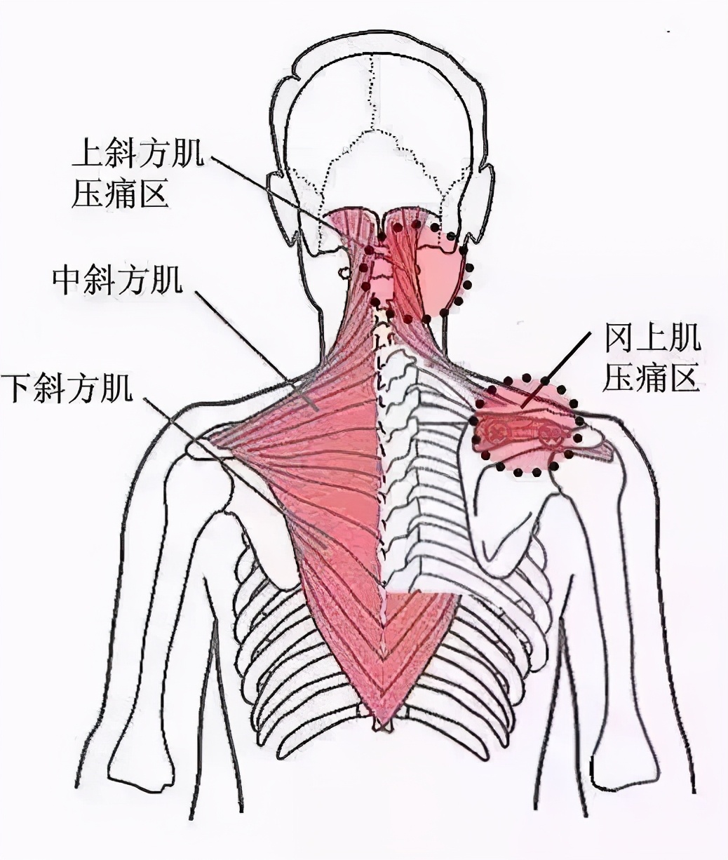 肩宽背厚脖子短，练出美肩关键在这一点