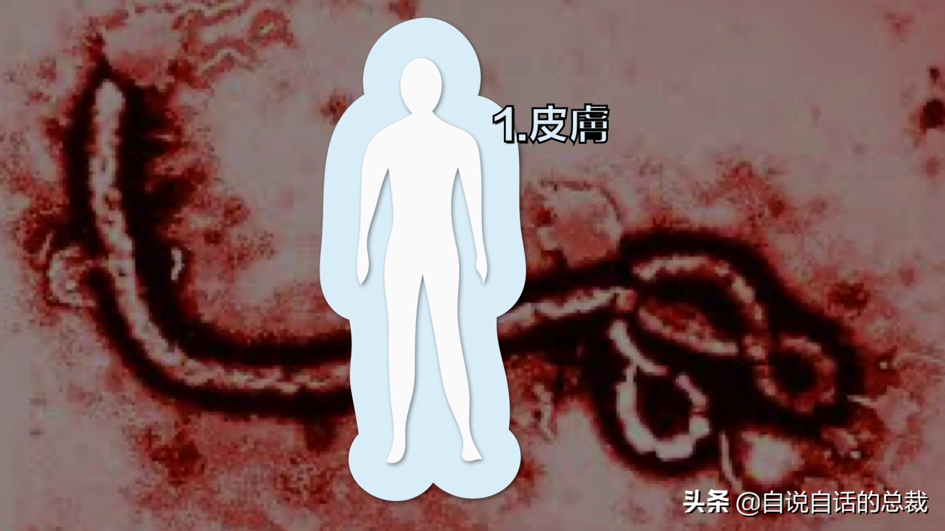 埃博拉：人类的诅咒，你的身体如何对抗它，它到底有多恐怖