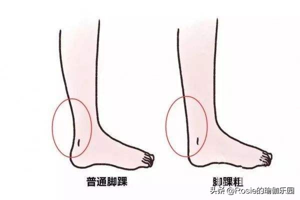高跟鞋好看穿上摔跤又崴脚？找对原因做好这3步，稳步态细脚踝