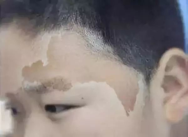 胎记是怎么来的？产科医生：孕期避开这3种行为，以免伤害到胎儿