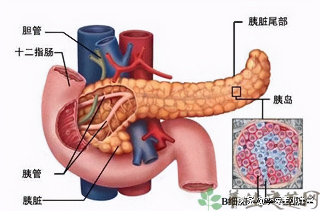 做彩超和增强CT都怀疑胰腺癌，做核磁没发现病灶，听医生怎么说