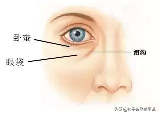 黑眼圈卧蚕别再傻傻分不清楚