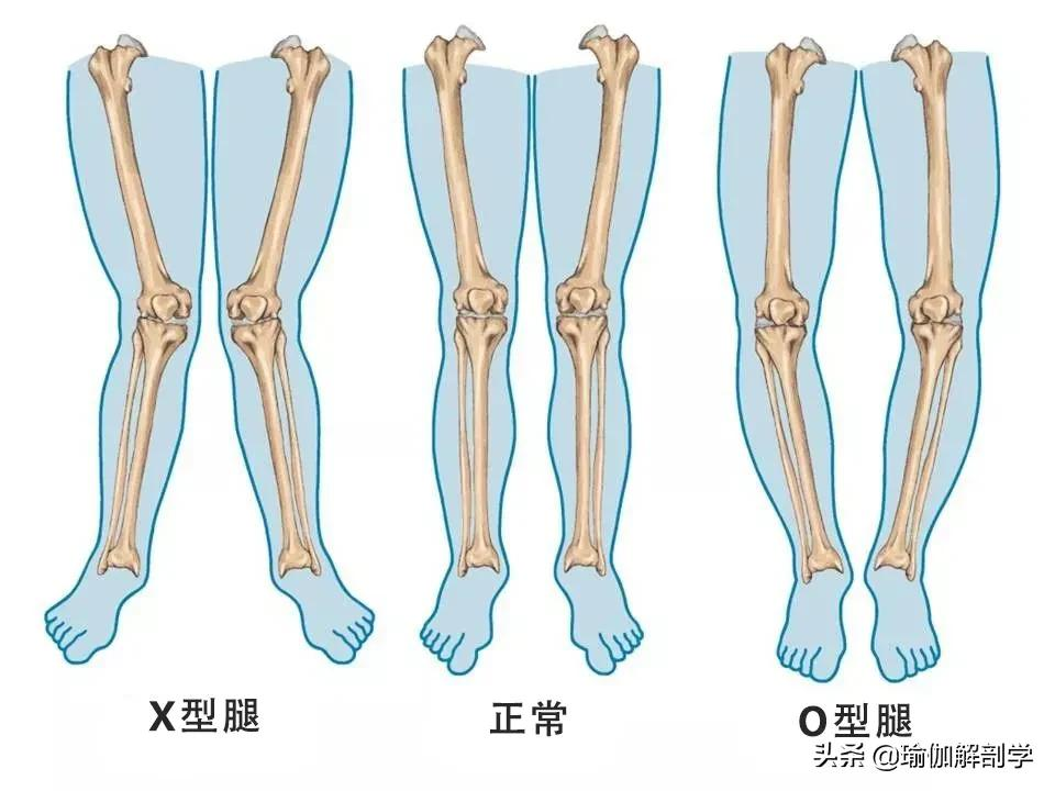 练瑜伽,什么是"x/o"型腿?如何矫正?(收藏级)