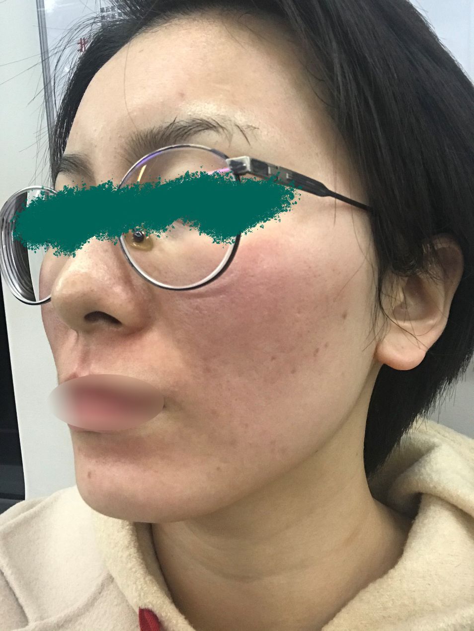护肤实录：真情推荐，这个效果人见人爱