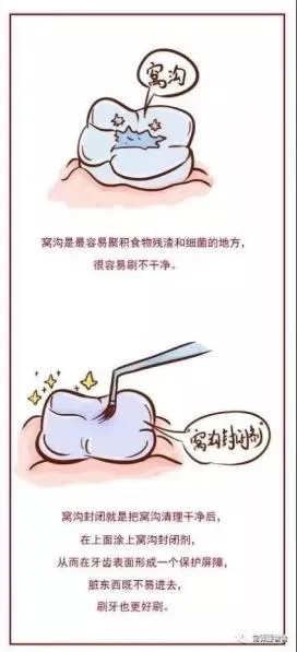 6-12岁换牙时间和换牙期问题大盘点!孩子一口好牙关键就在这几点