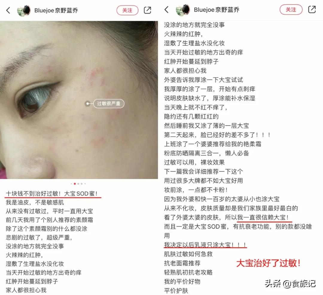 真情永不变，大宝天天见！80后90后，第一支护肤品绝对是它