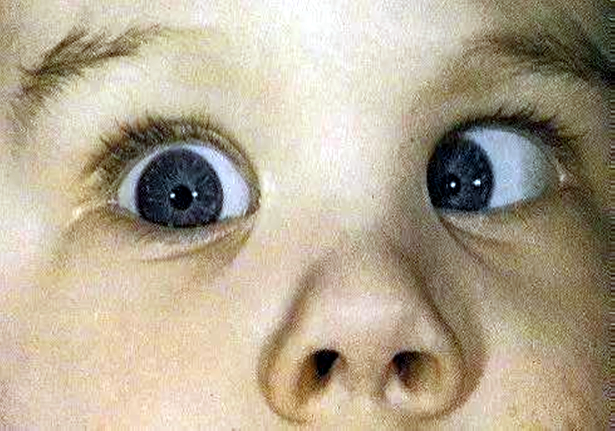 1岁宝宝求医遭拒,引家长不满,宝妈:斗鸡眼这么丑,凭啥不给治