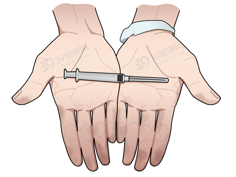 如何分辨一个人是否吸毒？看完这些吸毒者的典型症状，心里发毛