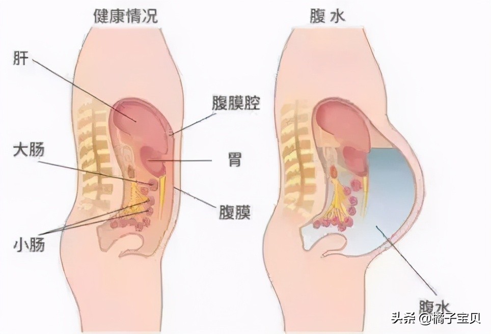 试管婴儿降调、促排、夜针期间注意事项大集合