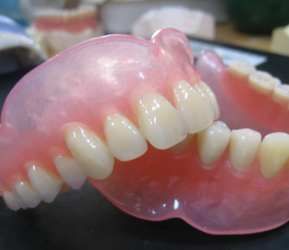 为什么说种植牙好于活动假牙和烤瓷牙?