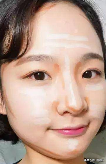 鼻子整形大概多少钱 大概费用 小城生活网