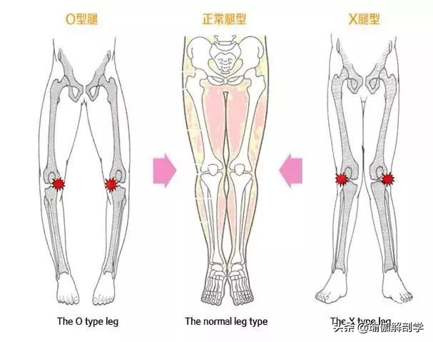 瑜伽体式中超伸是什么意思(练瑜伽，什么是超伸？超伸有什么危害，如何避免？)