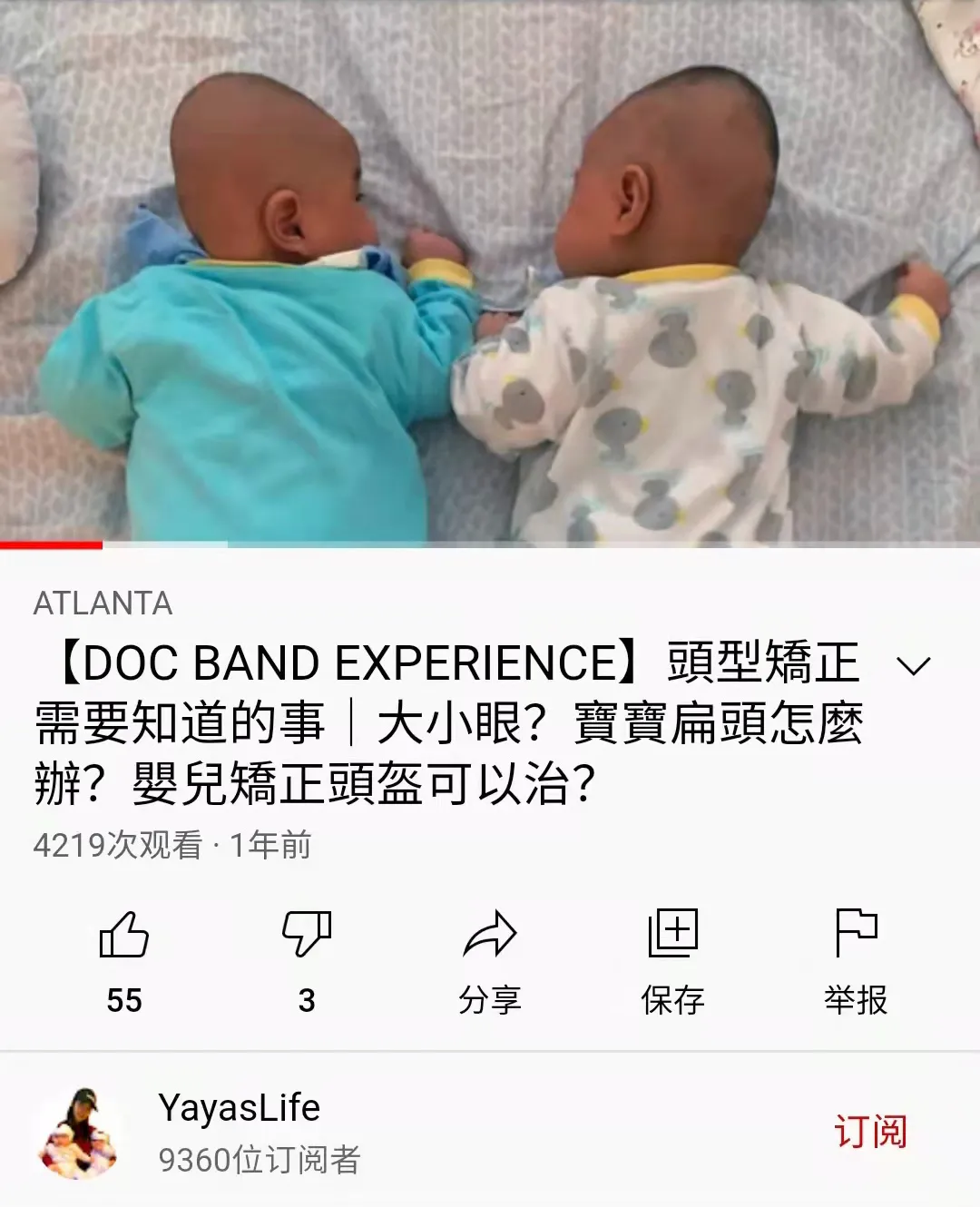 婴儿戴头盔，想变刘昊然