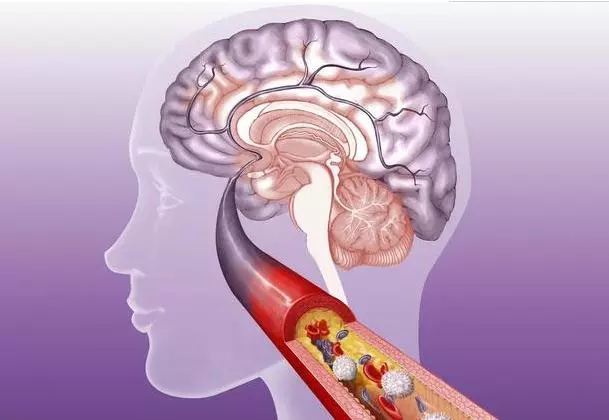 常见病和多发病有哪些（22种常见病的预防和治疗方法）